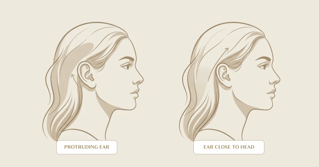 From Pinning to Pointing: Types of Cosmetic Ear Surgery Explained