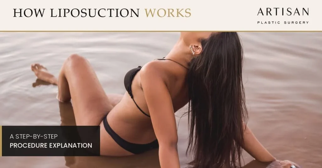 Inside Lipo Surgery: What Happens, How it Works - at Every Step