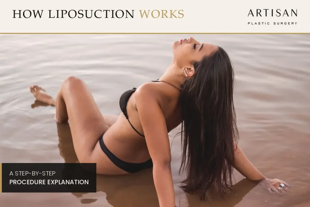 Inside Lipo Surgery: What Happens, How it Works - at Every Step